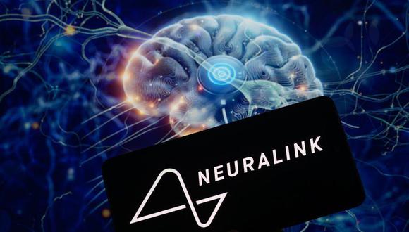El dispositivo de Neuralink transmite la actividad cerebral de forma inalámbrica. 