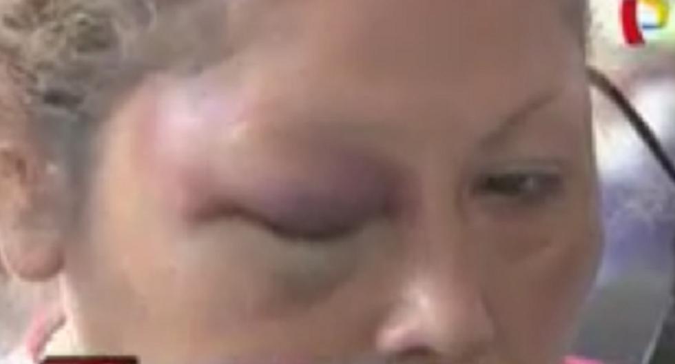Esta mujer fue agredida salvajemente por su hijo. (Foto: Captura de Canal 5)