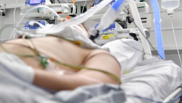 Un paciente de coronavirus yace en su cama en una unidad de cuidados intensivos (UCI) en un hospital de Salzburgo, Austria, el 17 de noviembre de 2021. (BARBARA GINDL / APA / AFP).