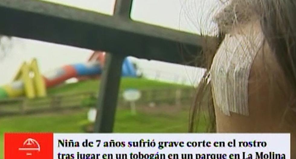 Niña sufre corte por tobogán en mal estado en parque municipal de La Molina. (Foto: Captura)