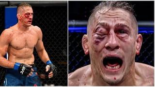 UFC 249: Niko Price terminó con un impactante corte en el ojo y perdió por nocaut ante Vicente Luque [VIDEO]