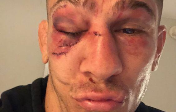 Luque se llevó la victoria por nocaut técnico. (Foto: Twitter:Nikohybridprice)