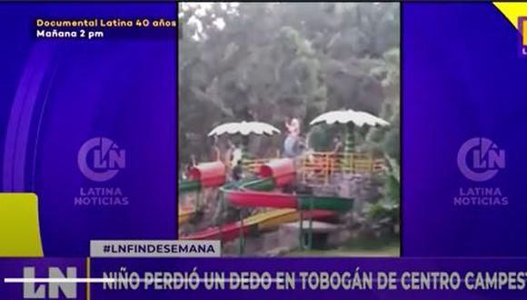 Un menor de 11 años perdió uno de los dedos de su mano en un centro campestre en Carabayllo. (Latina TV.)