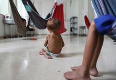 Brasil: niños yanomami desnutridos convalecen en un hospital de la Amazonía
