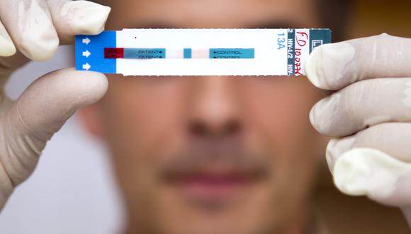 Imagen de un test de VIH. (Foto: Jody AMIET / AFP)