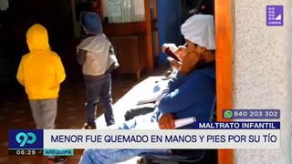 Arequipa: denuncian que sujeto quemó pies y manos de menor | VIDEO