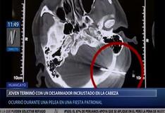Perú: joven acabó con desarmador incrustrado en la cabeza tras pelea