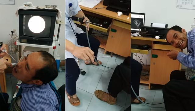 Sacan de la fosa nasal de un paciente una sanguijuela. Ocurrió en Vietnam. (YouTube | ViralHog)&nbsp;