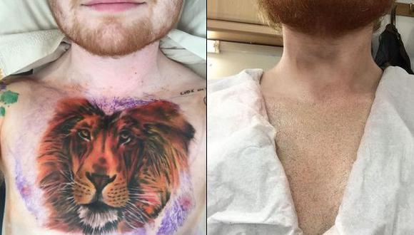 Ed Sheeran confirma que tatuaje de león era una broma