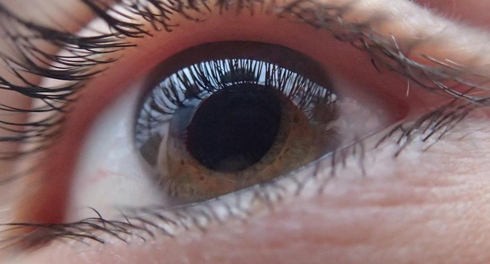 Detectar a tiempo el glaucoma podría evitar perder la vista en el futuro. (Foto: Pixabay/TobiasD)