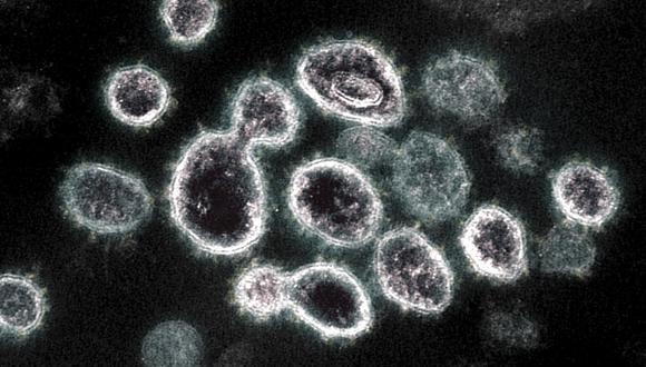 This undated handout image obtained March 28, 2021, courtesy of The National Institue of Allergy and Infectious Diseases/ NIH shows a transmission electron microscope image of SARS-CoV-2, the virus that causes Covid-19, isolated from a patient in the US, as virus particles are shown emerging from the surface of cells cultured in the lab, the spikes on the outer edge of the virus particles give coronaviruses their name, crown-like - The novel coronavirus has killed at least 2,777,761 people since the outbreak emerged in China in December 2019, according to a tally from official sources compiled by AFP at 10H00 GMT on March 28, 2021. At least 126,622,220 cases of coronavirus have been registered. The vast majority have recovered, though some have continued to experience symptoms weeks or even months later. (Photo by Handout / National Institute of Allergy and Infectious Diseases / AFP) / RESTRICTED TO EDITORIAL USE - MANDATORY CREDIT "AFP PHOTO /NATIONAL INSTITUTE OF ALLERGY AND INFECTIOUS DISEASES/NIH/HANDOUT " - NO MARKETING - NO ADVERTISING CAMPAIGNS - DISTRIBUTED AS A SERVICE TO CLIENTS