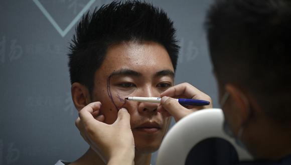 Esta imagen tomada el 15 de julio de 2021 muestra a un médico marcando el rostro del investigador científico Xia Shurong antes de someterse a una cirugía plástica en una clínica en Beijing. (WANG ZHAO / AFP).