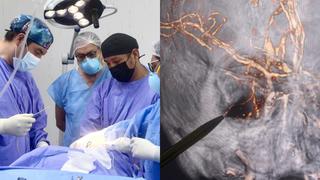 Médicos salvan la vida de joven que tenía incrustada tabla de madera de dos metros en el ojo y cerebro 