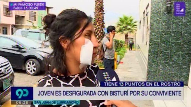 Milagros Rojas resultó con 13 puntos en el rostro tras ser atacada con bisturí por su pareja (Captura: Latina)