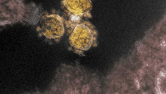 Imagen del SARS-CoV-2 tomada por el National Institutes of Health (NIH). (Foto: Handout / National Institutes of Health / AFP)