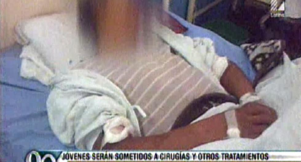 Menor está internado en hospital de Arequipa. (Foto: Captura 90 Segundos)