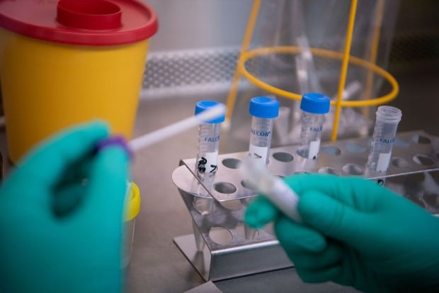 Autoridades de Salud del Estado de Baden-Wuerttemberg trabajan en una muestra de prueba de un caso sospechoso del Nuevo Coronavirus 2019 (2019-nCoV) en Stuttgart, Alemania (Foto: AFP)