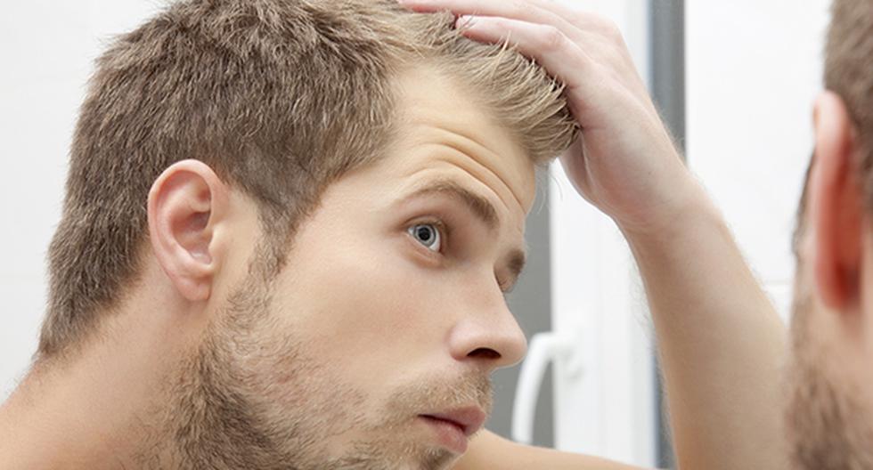 Los hombres mayormente sufren de la caída del cabello. (Foto: IStock)