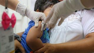 Detectan segundo caso de sarampión a nivel nacional en Juliaca