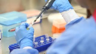 Coronavirus en Perú: SuSalud informa que 102 clínicas privadas son investigadas por cobro indebido de pruebas moleculares de COVID-19