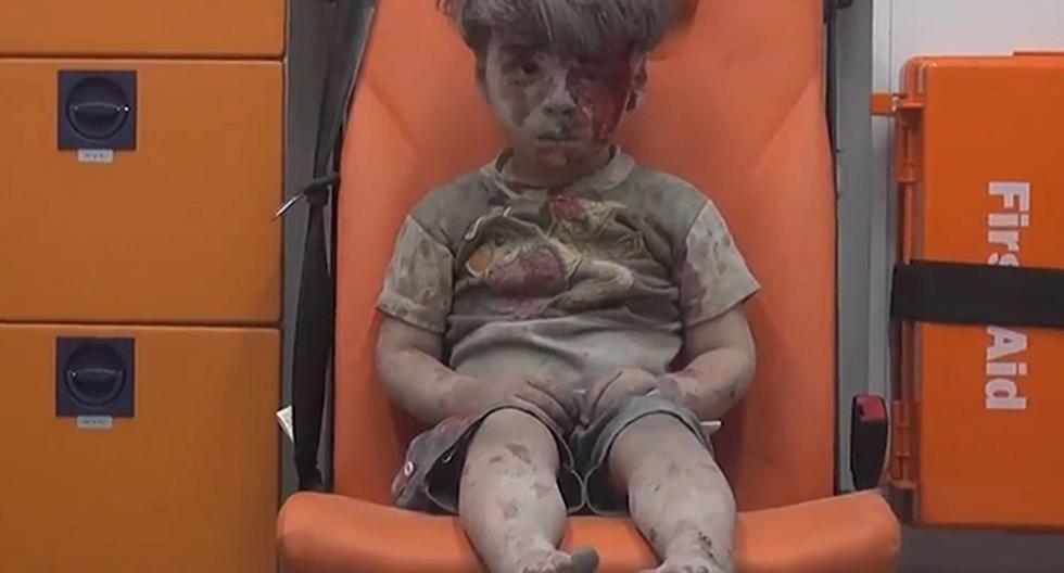 La imagen de un niño herido llama la atención sobre el drama de Siria. (Foto: EFE)