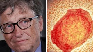 El pronóstico que Bill Gates hizo sobre la viruela que podría estar próximo a volverse realidad