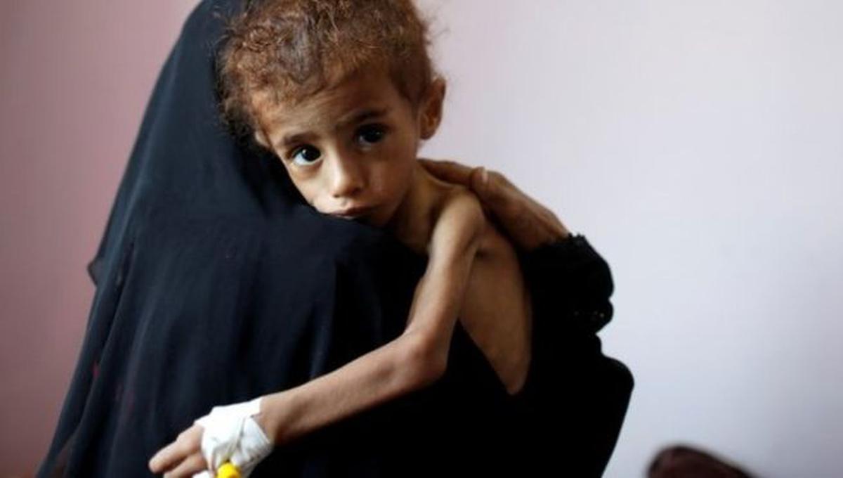 La guerra de Yemen está considerada como la mayor crisis humanitaria del mundo. Foto: GETTY IMAGES, vía BBC Mundo