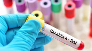 Colombia detecta el primer caso de hepatitis aguda de origen desconocido