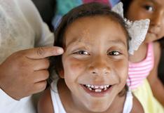 EEUU: Le devolverán la sonrisa a niña latina de Los Ángeles