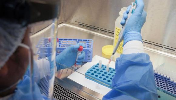 Hospital Nacional Hipólito Unanue tiene proyectado procesar más de 2.000 pruebas moleculares de descarte de COVID-19 mensuales. (Foto: Minsa)