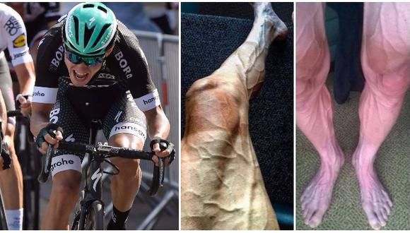 Tour de Francia: ¿Por qué se ven a así las piernas de un ciclista tras 16 etapas? (Foto: Agencias / Instagram)