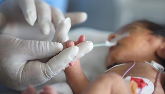 Según la Organización Mundial de Salud, prematuro es todo bebe nacido vivo antes de las 37 semanas de gestación. (Foto: EsSalud)