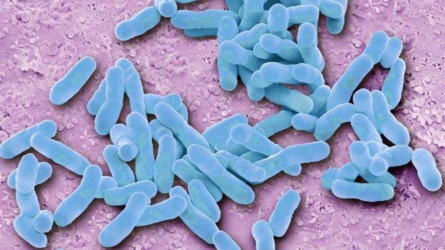 El E. coli es una de las bacterias más temidas pero la mayoría de los microbios que viven en tu casa son inofensivos y algunos hasta nos hacen bien. (Foto: Science Photo Library)