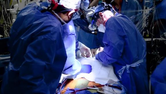 El equipo de cirujanos de la Universidad Maryland Medical School trasplantó con éxito el corazón de un cerdo modificado genéticamente a un humano. (Foto: Captura YouTube)
