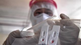 Coronavirus | La nueva prueba de anticuerpos que es “crucial” para hacer frente al COVID-19 