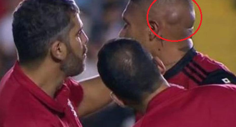 Paolo Guerrero sufrió golpe en la cabeza tras un choque con Henrique | Foto: Captura
