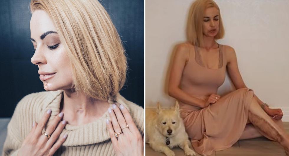 Una cantante y actriz deslumbró al Internet con su canto tras superar una terrible enfermedad bucal. (Foto: Real Elly Brown en YouTube/Instagram)