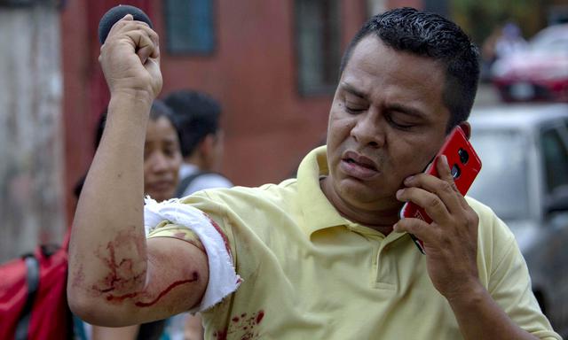 Nicaragua | Daniel Ortega | Entre los heridos se encuentra el periodista nicaragüense Wiston Postome, quien recibió un disparo en uno de sus brazos. (EFE).