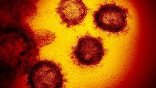 Coronavirus | Por qué se llama así y otros datos sobre el virus que ha puesto en alerta al mundo | FOTOS