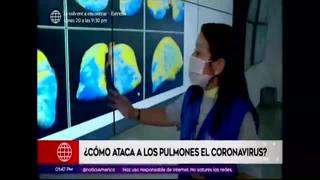 Coronavirus en Perú: ¿Cómo ataca a los pulmones el Covid-19?