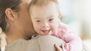 La drástica caída de nacimientos de bebés con síndrome de Down en Europa (y el debate que genera)