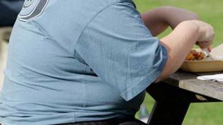 La obesidad puede reducir hasta 8 años la expectativa de vida