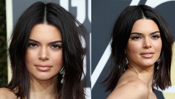 A inicios de este año, la modelo Kendall Jenner reconoció que sufría
de acné y que esto le hacía sentir “ansiosa, indefensa e insegura”. (Foto: AFP)