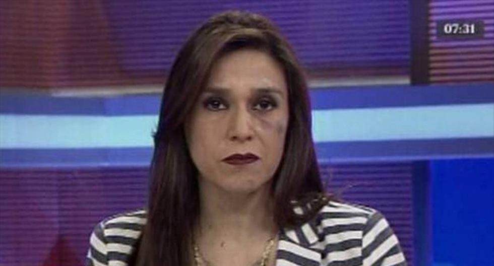 Verónica Linares lució con un moretón en el rostro en pleno programa. (Foto: América TV)