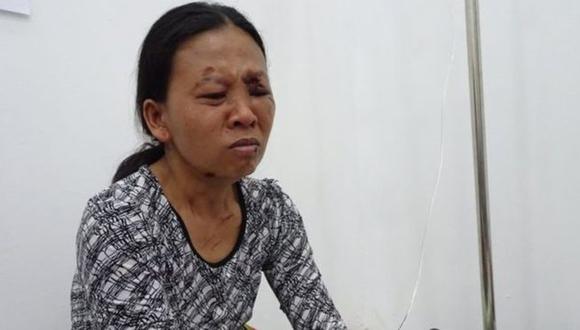 Emilia sobrevivió al tsunami en Indonesia, pero perdió a su hija y sufrió severas heridas.