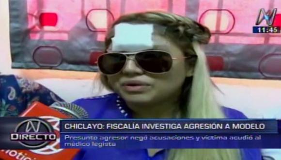 Chiclayo: acusado de agredir a modelo negó ataque en discoteca