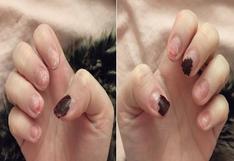 Bloguera muestra las consecuencias de usar uñas acrílicas