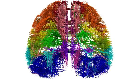 Científicos presentan "mapa" con conexiones del cerebro humano