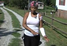 Mujer defiende a pitbull que casi le rompe el brazo y mató a una persona