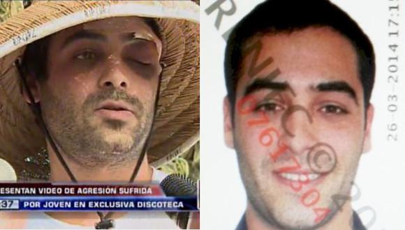 Miraflores: joven atacado en una discoteca casi pierde la vista